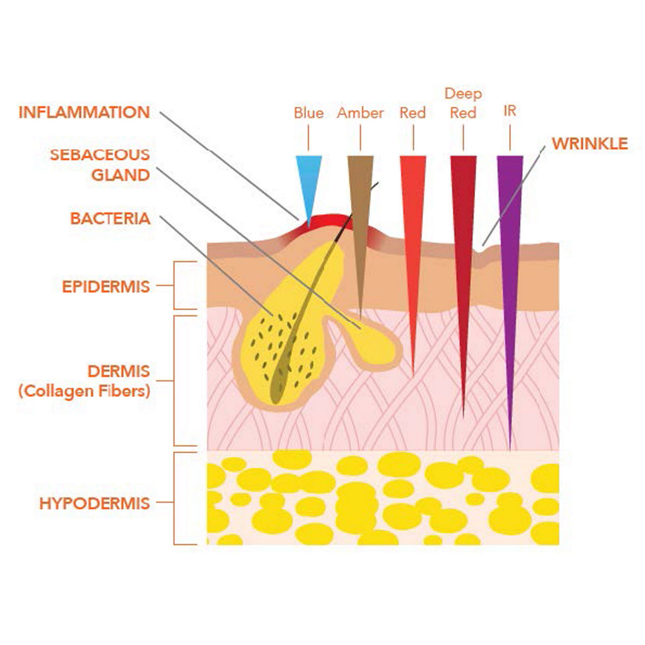 SpectraLite™ FaceWare Pro SpectraLite™ FaceWare Pro