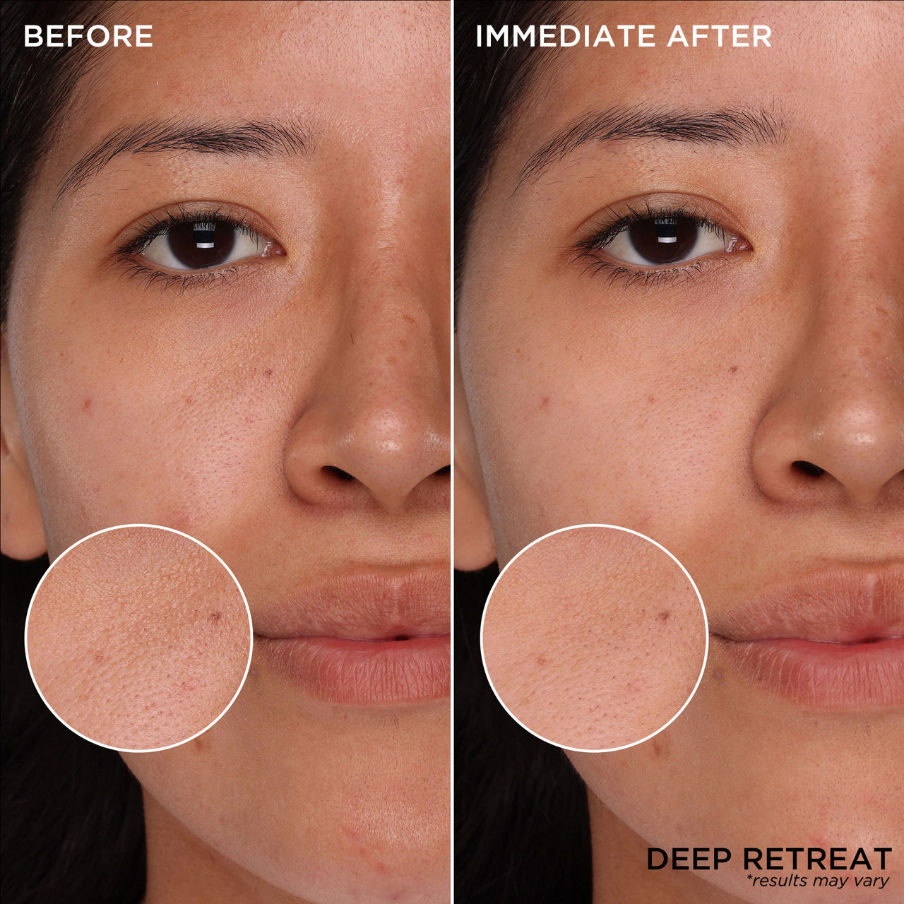 The POREfessional Picks The POREfessional Picks